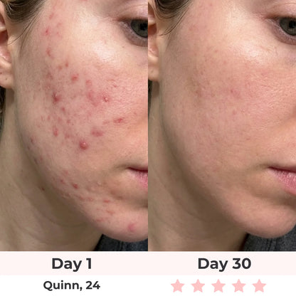 GlowPro™ 7-in-1 Facial Sculptor