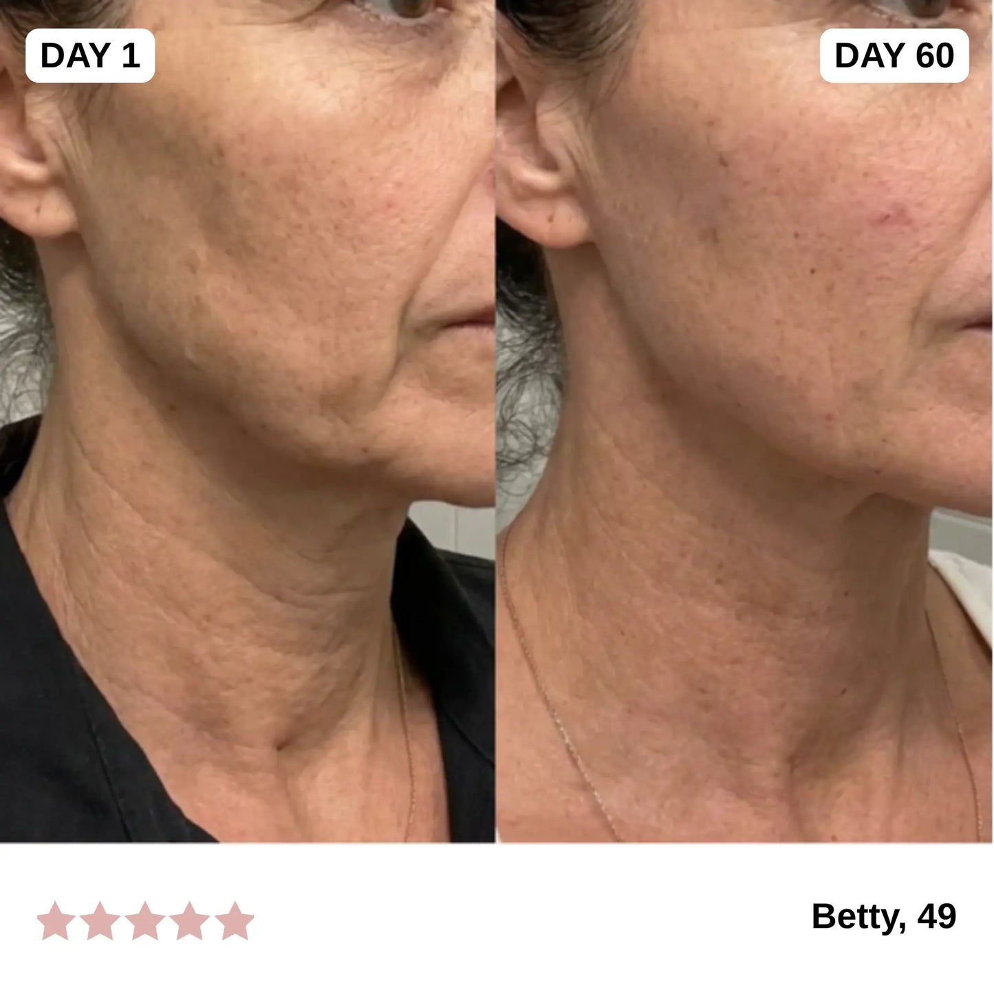 GlowPro™ 7-in-1 Facial Sculptor