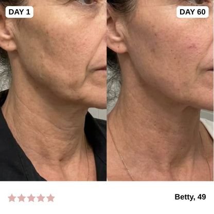GlowPro™ 7-in-1 Facial Sculptor